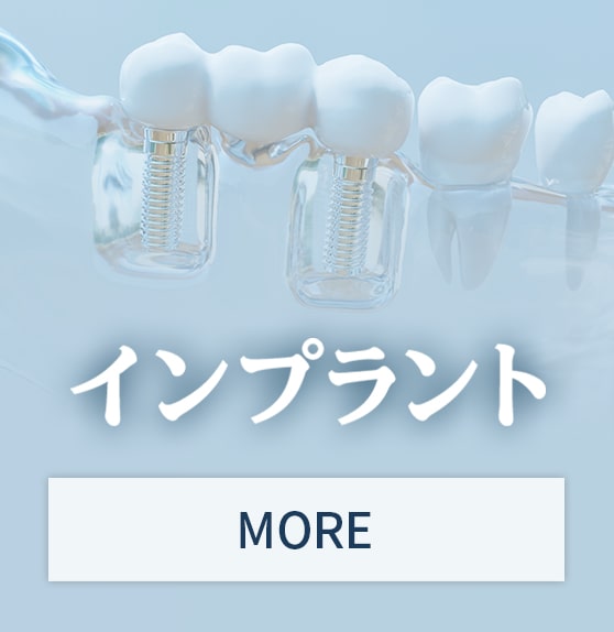 インプラント